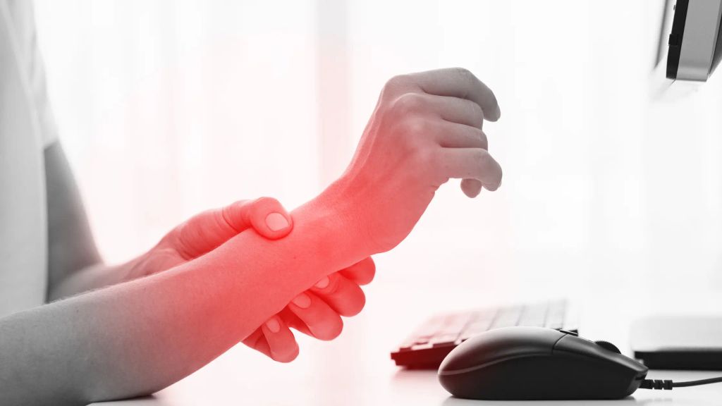 síndrome del túnel carpiano